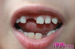 个别想要炒现货黄金讨教何如申请开户呢，采选金荣中国免佣-灵便热播，炒表盘黄金私家是怎么开户的什么流程，资产增值之旅7周年独特举动