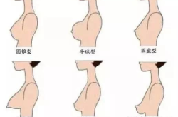 女生的胸下垂,胸下垂的优雅与自信