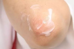 三角区毛孔里面黑黑的,揭秘三角区毛孔黑头成因与应对策略